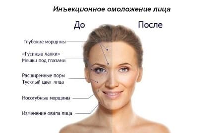 Омоложение Омоложение