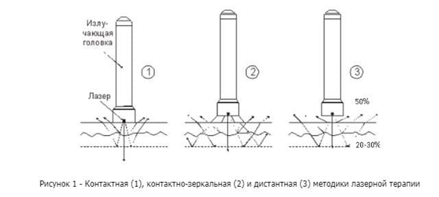 При чрескожных процедурах излучение может по-разному влиять на покровы При чрескожных процедурах излучение может по-разному влиять на покровы