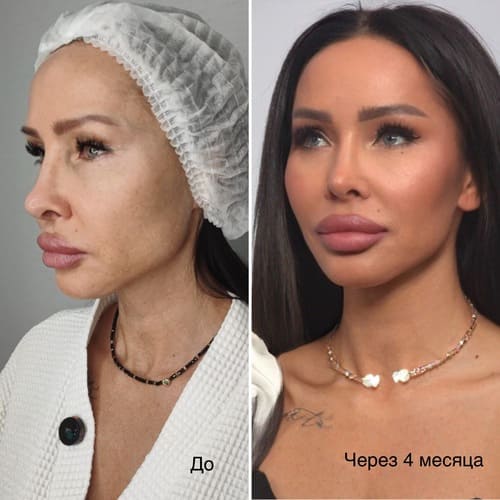 Фото до/после №2