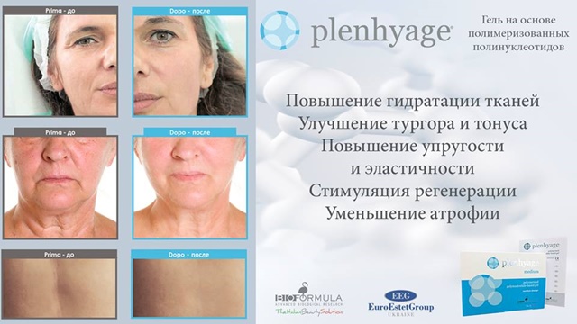 Plenhyage (Италия)