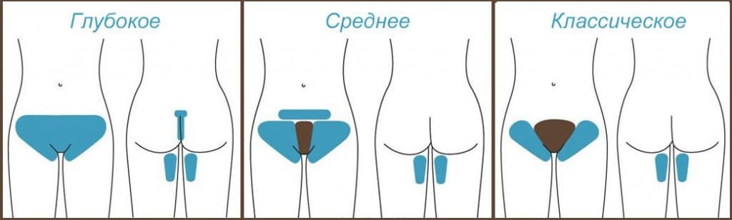 шугаринг