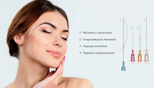Материалы для тредлифтинга мезонитями Материалы для тредлифтинга мезонитями