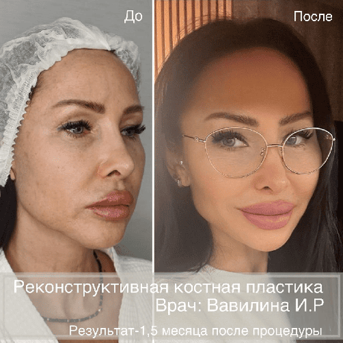 Фото до/после №1